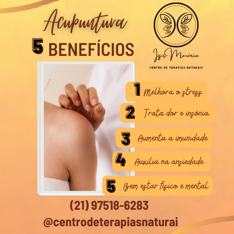 Acupuntura