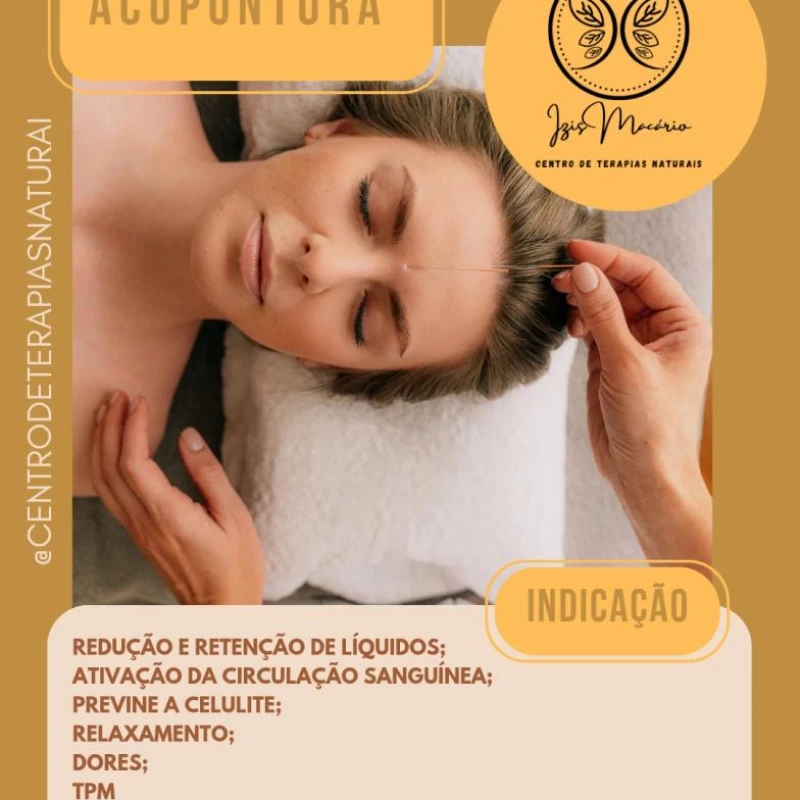 Acupuntura
