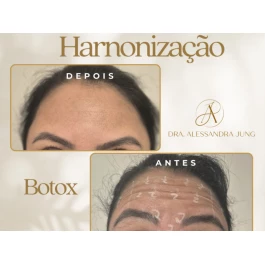 Harmonização Orofacial