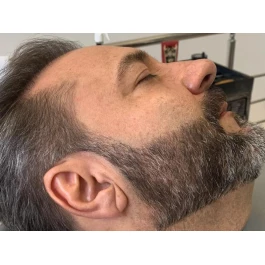 Full Barba (Micropigmentação de Barba)