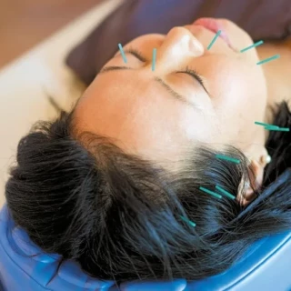 Craniopuntura de Yamamoto