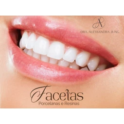 Foto Facetas de Resina e Porcelana