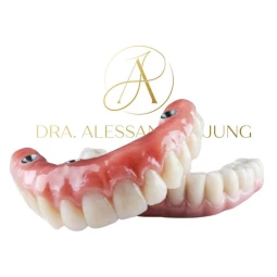 Foto Implantes Dentários