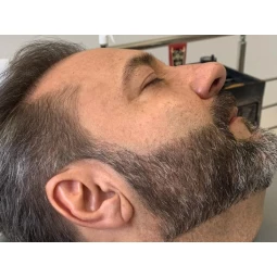 Foto Full Barba (Micropigmentação de Barba)