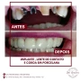 Foto 1:  Tania Grecco cirurgia dentista