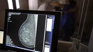 Foto: Nova lei reforça direito a três folgas por ano para exames preventivos