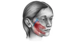 Fisioterapia na Paralisia Facial