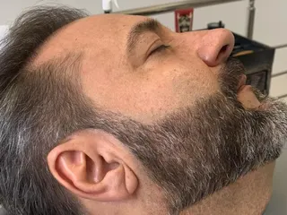Full Barba (Micropigmentação de Barba)
