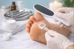 Tratamento para Calosidades e Fissuras Plantares
