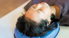 Craniopuntura de Yamamoto