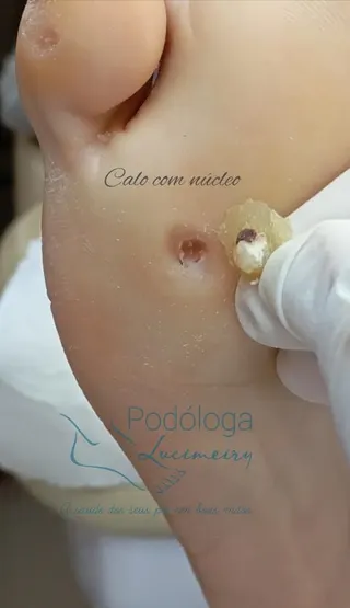 Lucimeiry Podóloga, foto 5