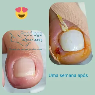 Lucimeiry Podóloga, foto 3