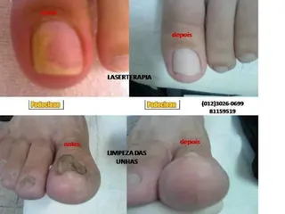Podoclean - Podologia  e Laserterapia, foto 2