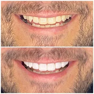 SorriMaxx, foto 5