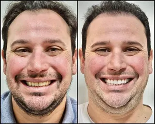 SorriMaxx, foto 4