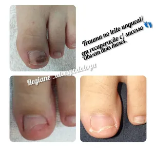 Regiane Alves Podologia e Estética, foto 2