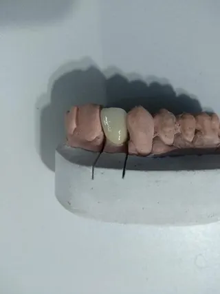 L.A Laboratório de Prótese Dentária, foto 4